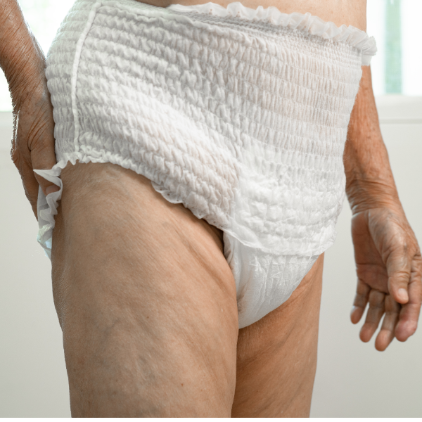 Pflegedienst und Seniorenbetreuung CuraVital-IKM-Wechsel-Frau trägt Windel Pflegedienst und Seniorenbetreuung CuraVital-IKM-Wechsel-Frau trägt Windel